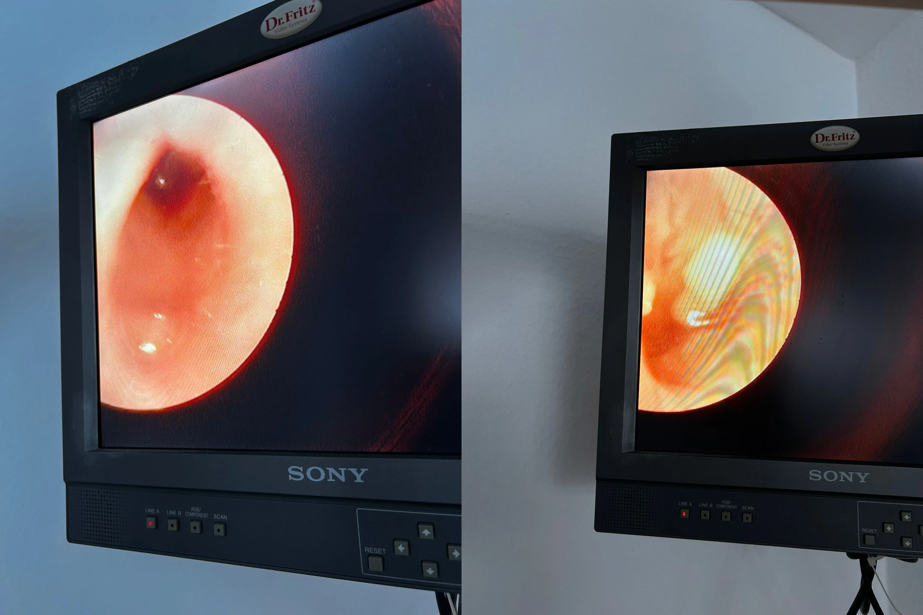 Beitragsbild zu Moderne Videoendoskopie für eine präzise Untersuchung des Gehörgangs